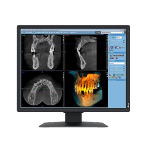 RADIFORCE MED CLINICAL REVIEW COLOR